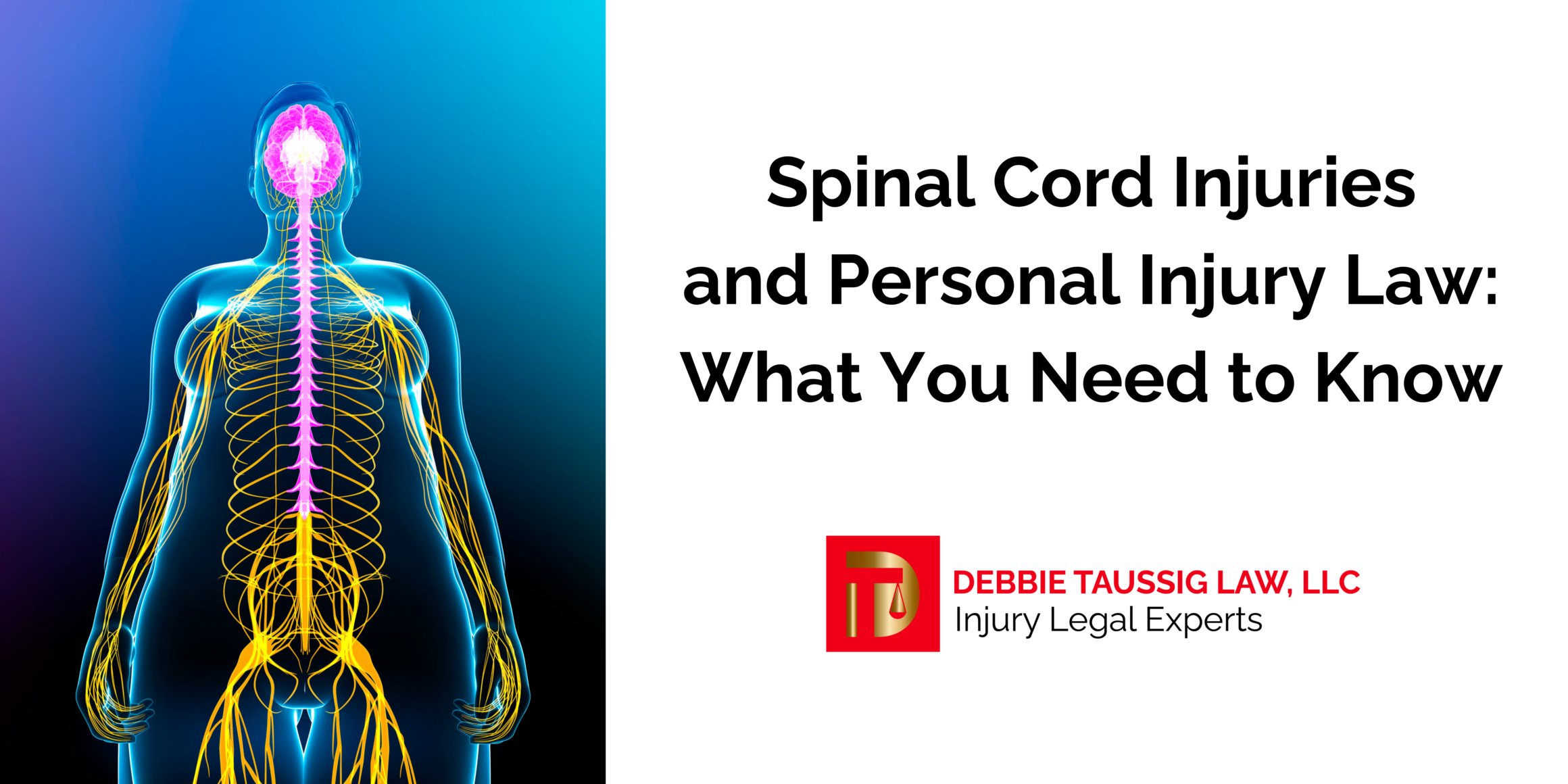 Spinal Cord Injuries and Personal Injury Law: What You Need to Know