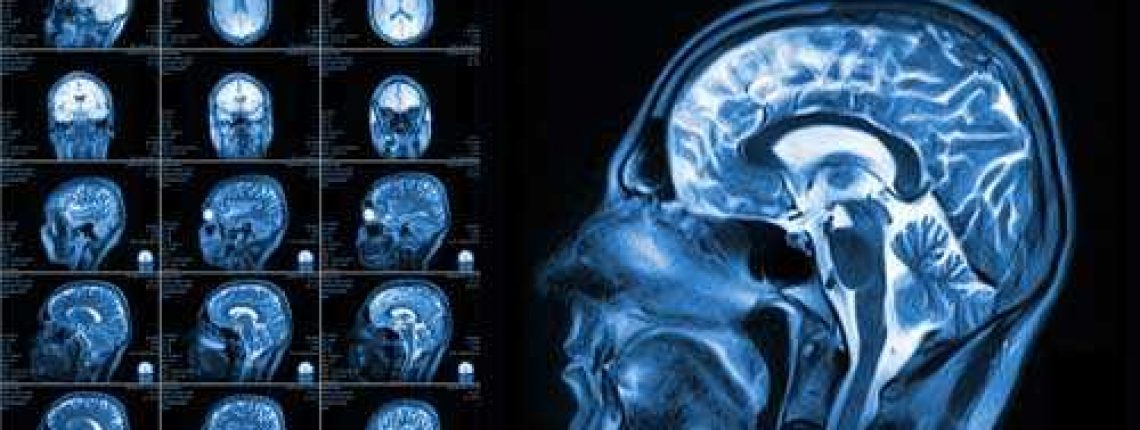 head-xray-profile-sm